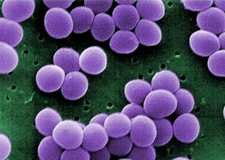 <i>Staphylococcus aureus</i>