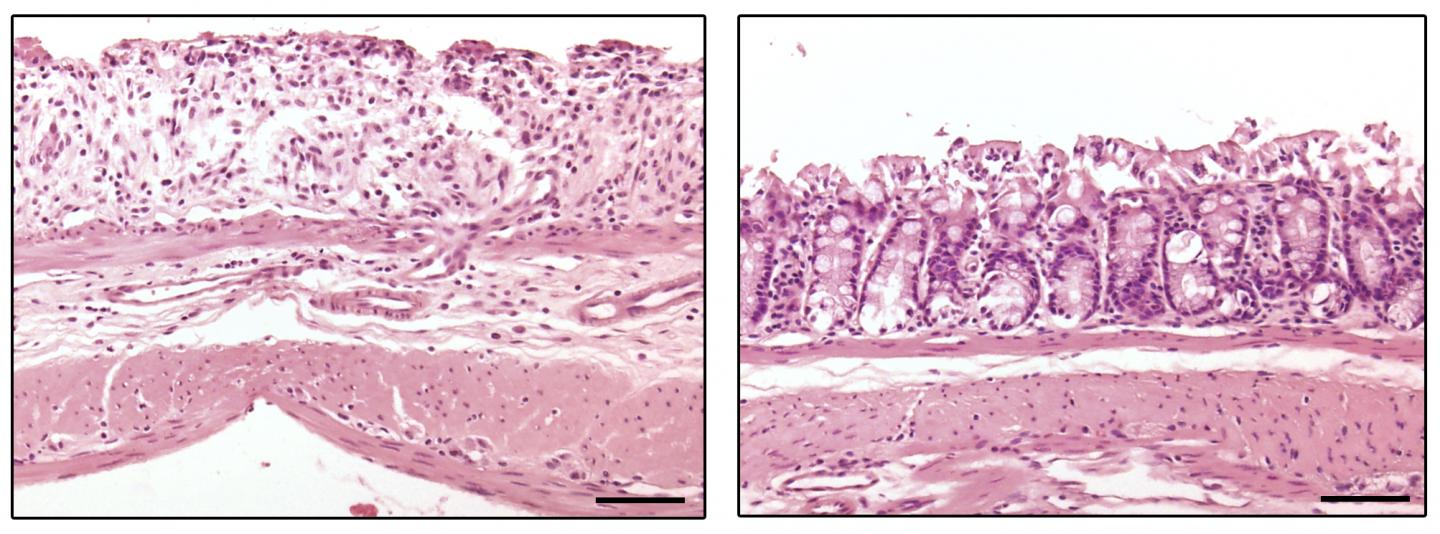 miR-223 Reduces Intestinal Inflammation