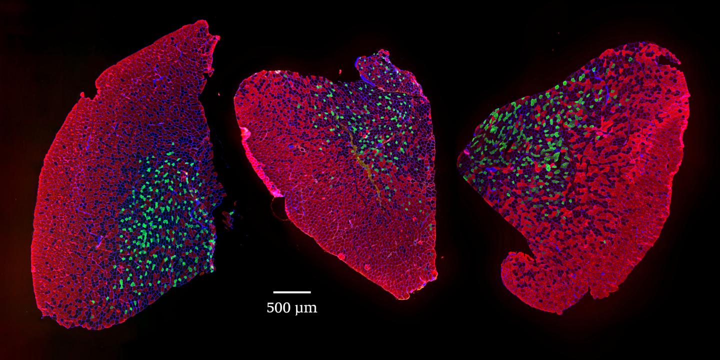 Age-related muscle wasting in mice