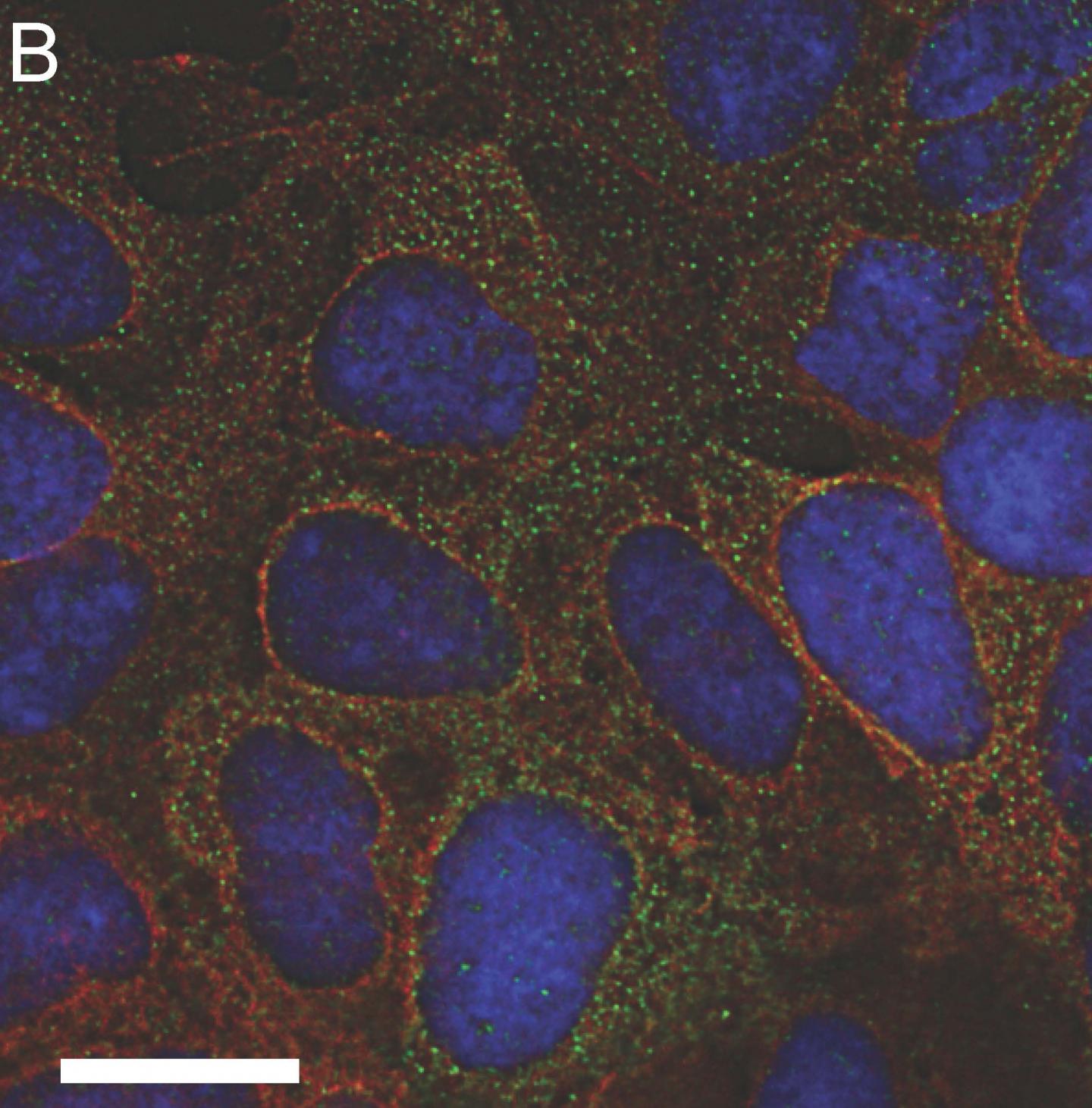 RNA Binding Protein Supports Harmful Tau Buildup in Alzheimer's Disease (1 of 1)