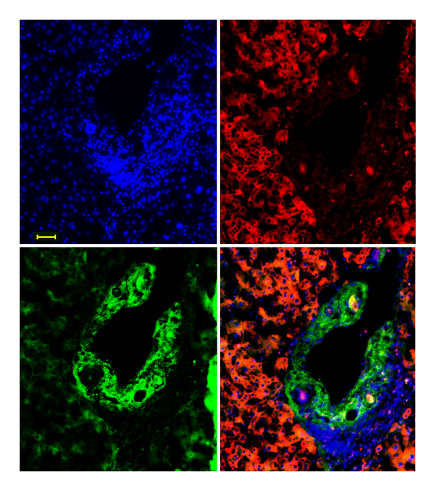 pVHL and SMAD occur complementary