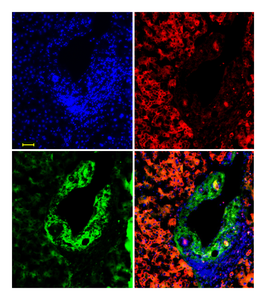 pVHL and SMAD occur complementary