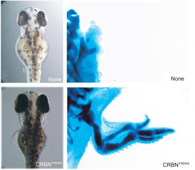 Why Thalidomide Causes Limb Deformities