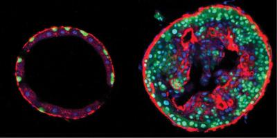 Cross Section of a Fly Intestine