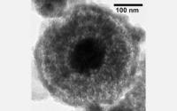 Photo of Transmission Electron Micrograph Showing Nanoparticles