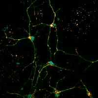 Neurons in Mouse with Gaucher Disease