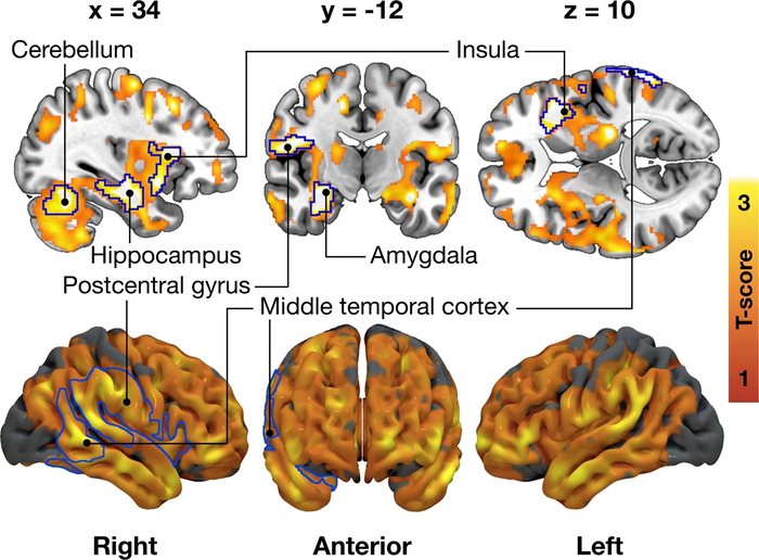 Brain regions