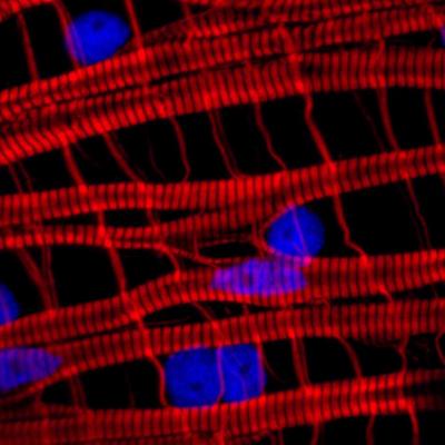<i>Clytia</i> Striated Muscle