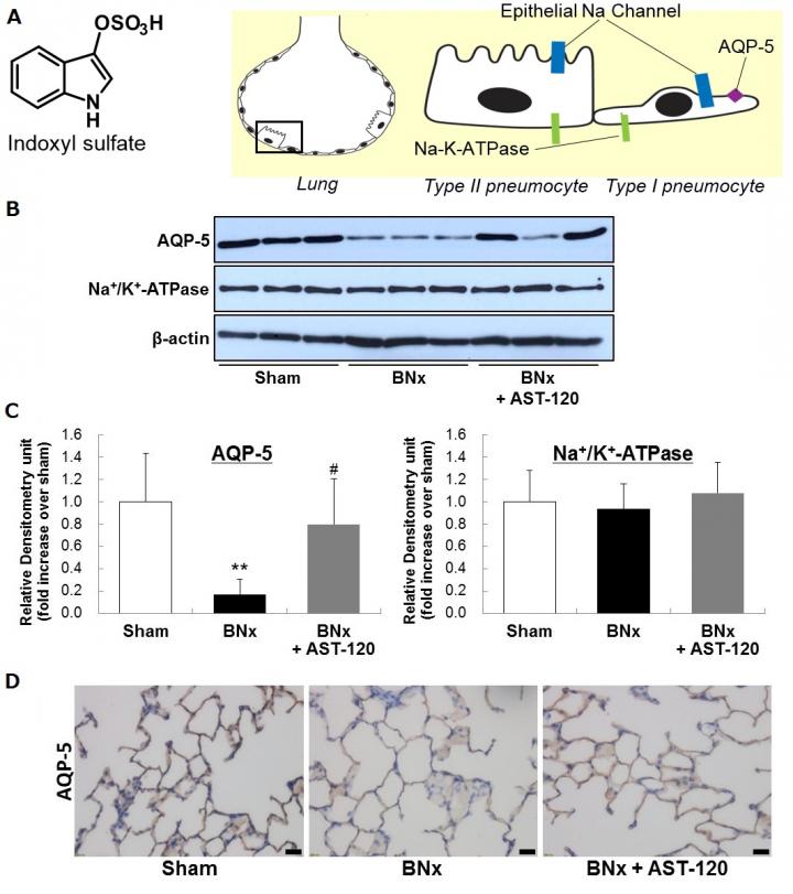 Down-Regulation of Pulmonary AQP-5 in AKI and its Recovery by AST-120 Treatment