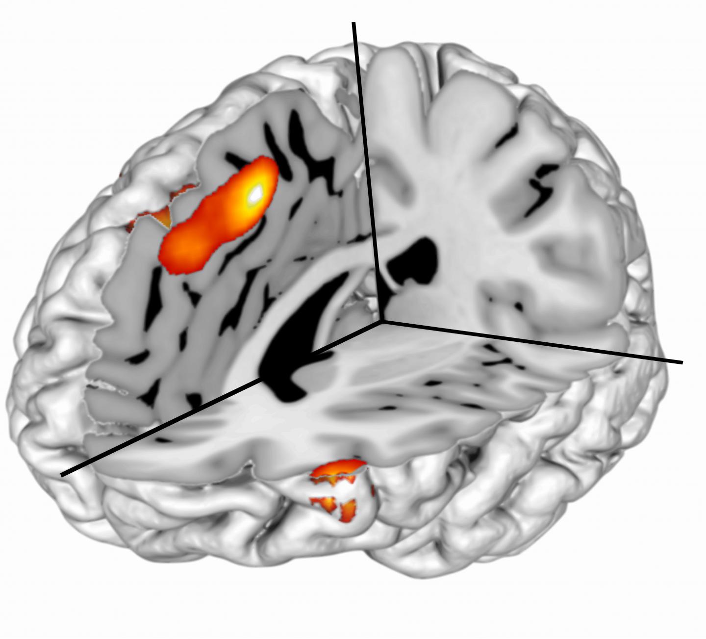 Scientists Discover dACC Activity During Motivated Control Reflects the Calculation of Surprise