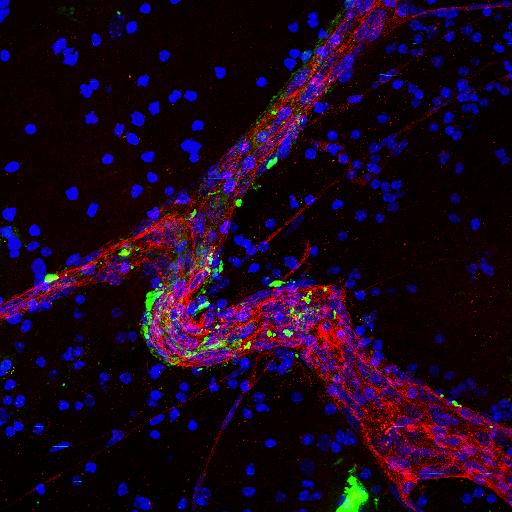 Large Blood Vessel (Red) 