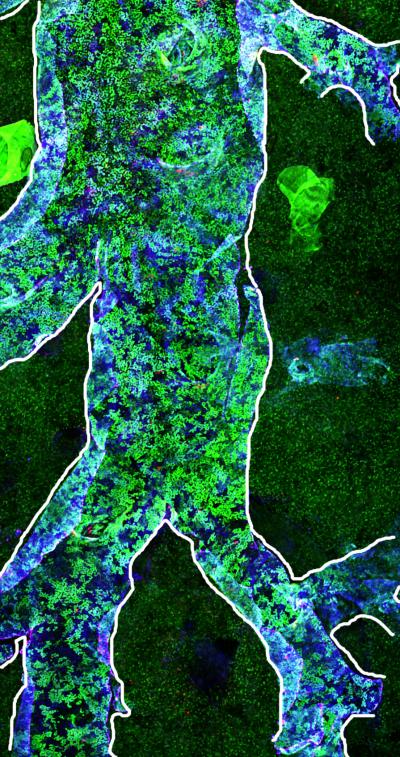 Airway Before Severe Injury