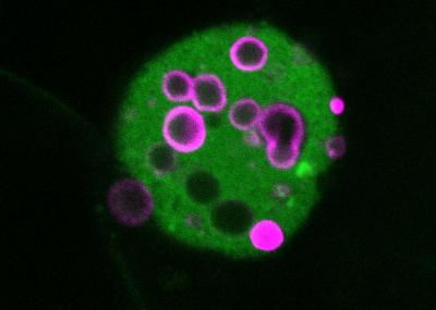 Origin of Calcium-Based Deposits in the Eye