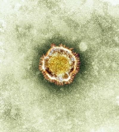 Human Coronavirus-Erasmus Medical Center