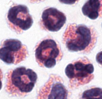 Eosinophils