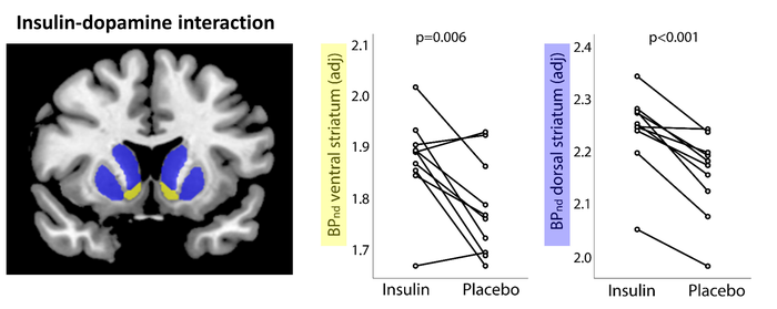 Insulin-Dopamin Interaction