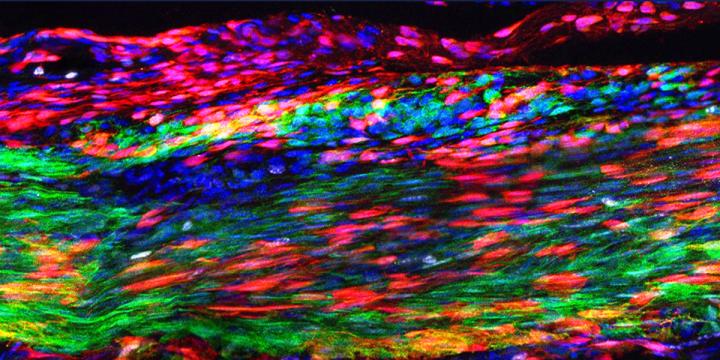 Tendon Stem Cells Revealed