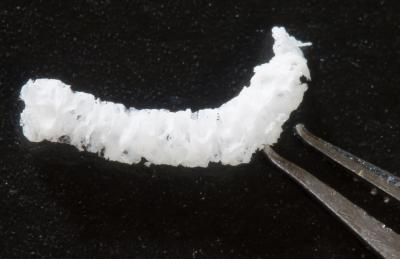 Example of Silk Implant Used in the Study