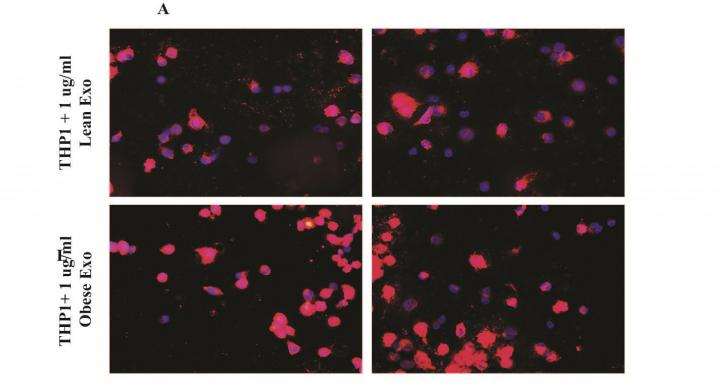Effect on THP-1 Cells of Adipocyte-Derived Extracellular Vesicles on Cholesterol Efflux