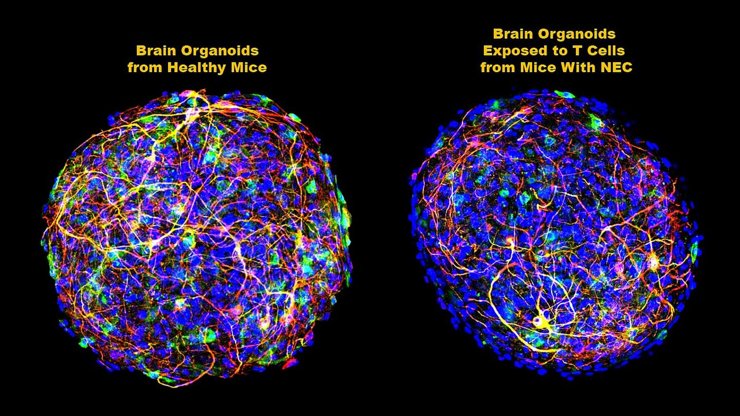 Brain organoids