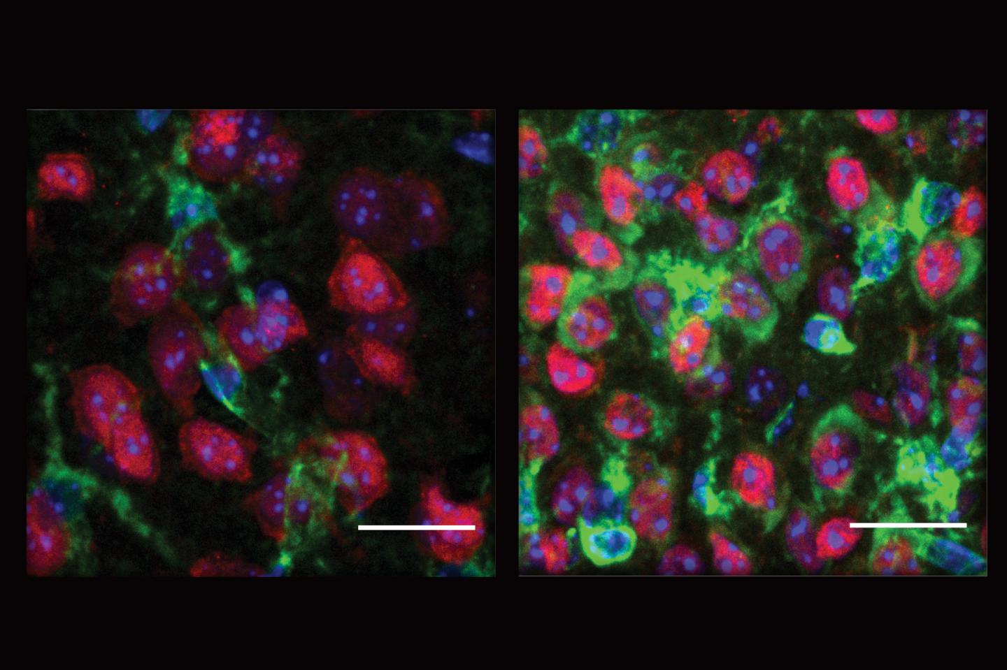 Immune Response