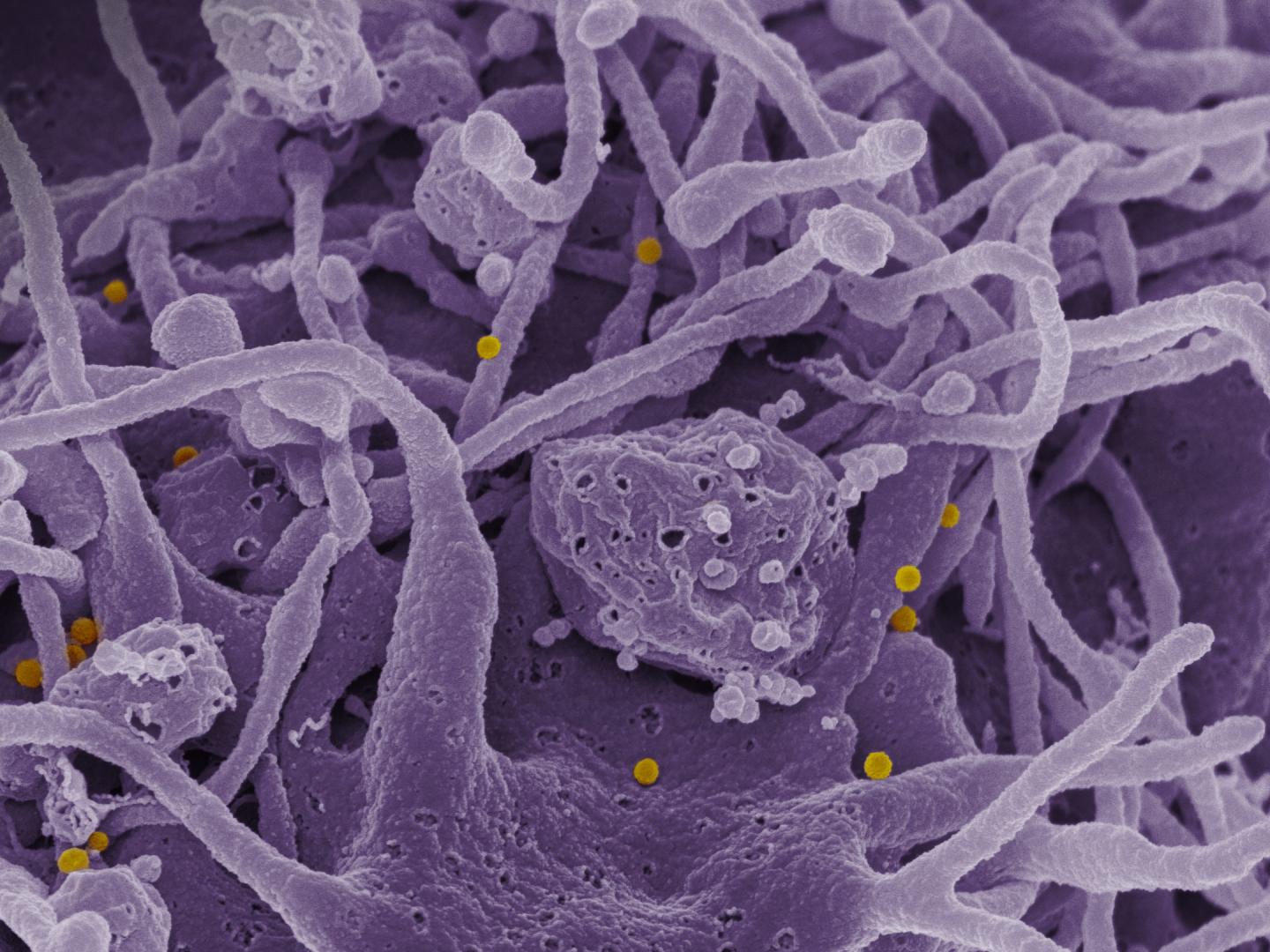 Scanning Electron Micrographs of CCHF Viral Particles
