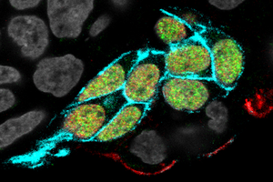 Generating sperm precursors in the lab