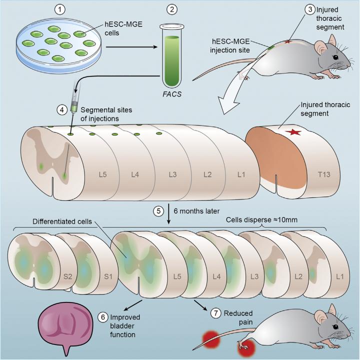 Human Stem Cells in Mouse Model of Spinal Cord Injury