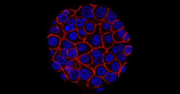 Pancreatic cancer cells