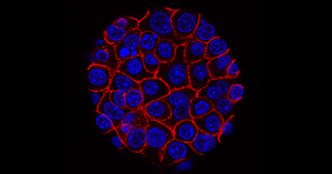 Pancreatic cancer cells