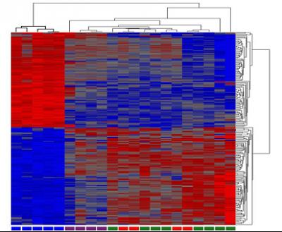 Malfunctioning Gene Associated with Lou Gehrig's Disease Leads to Nerve-Cell Death in Mice (2 of 2)