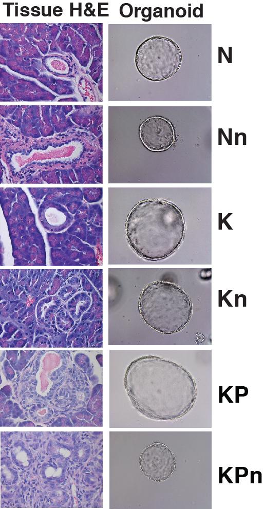 Making Pancreas Organoids to Test New Therapies