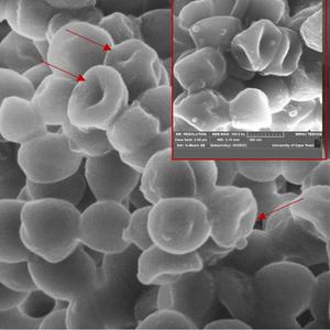 SEM image of lesions in cell membranes of S. aureus