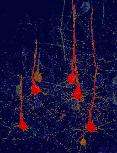 Neurons Converted from Glial Cells