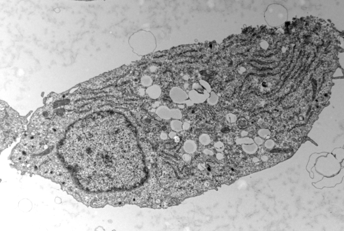 Pancreatic beta cell