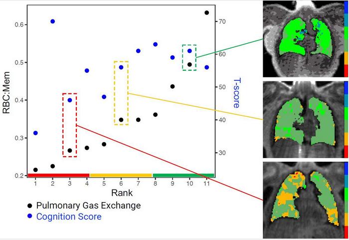 Long COVID Brain Fog Linked to Lung Function