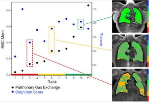 Long COVID Brain Fog Linked to Lung Function