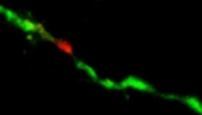 Neuronal Dendrite Protein Synthesis