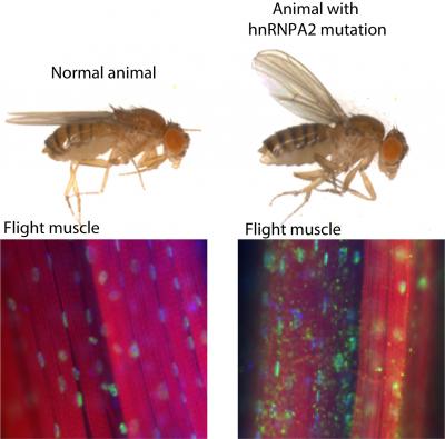 Disease-Causing Proteins in Brain Disorders