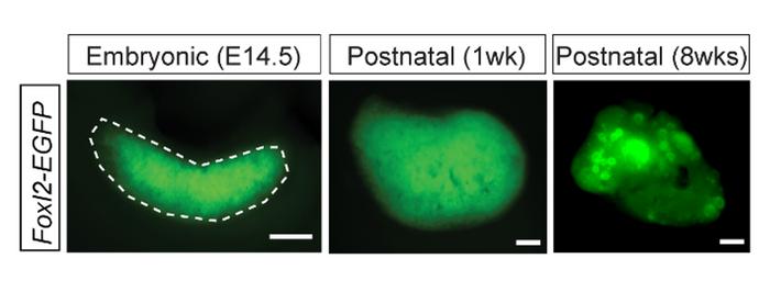 Fluorescent imaging of FOXL2 pre and post birth