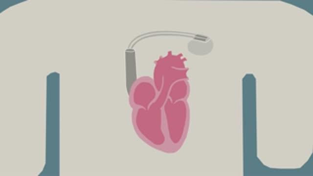 Biological Pacemaker Cells Reset Heartbeats