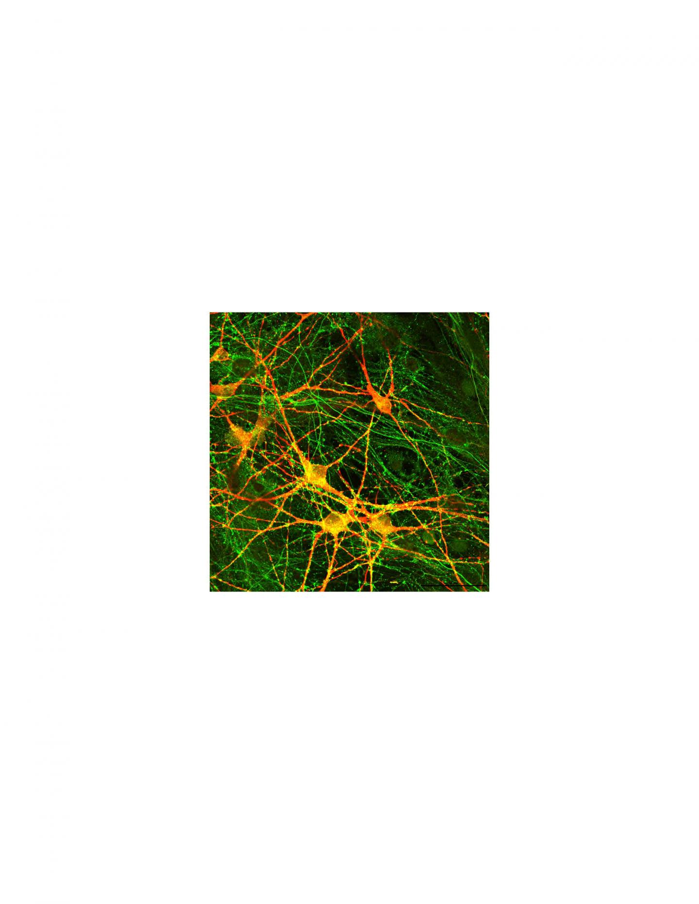 Human-derived neuron