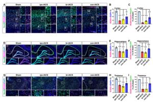 The immunofluorescence of Rgs9+ neurons in intracranial alternating current stimulation (iACS)-treated rat brain