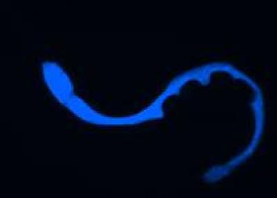 Wave of Blue Fluorescence Tracks the Spread of Death in <i>C.elegans</i>