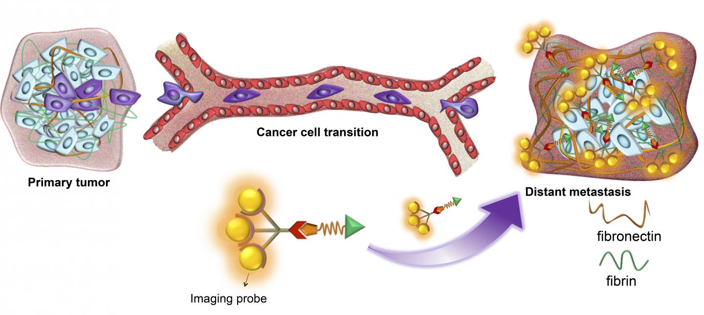 With New Contrast Agent, MRI Detects Micrometastases in Mice