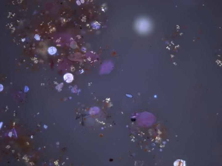 A Lake Stechlin Water Sample Showing Microscopic Fungi (Marked with Sapphire-Blue Spots)