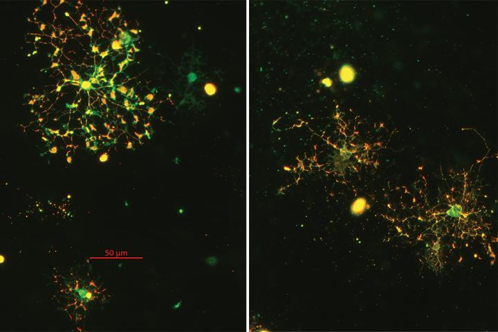 Oligodendrocytes Cells