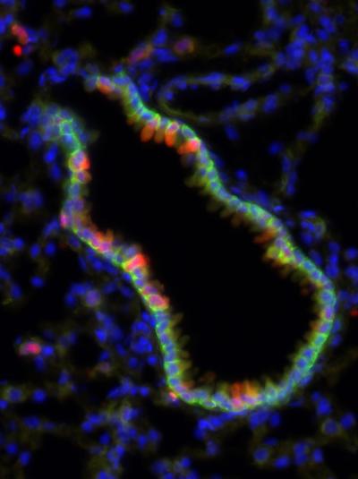 The Airways of the Mouse Lung (2 of 2)