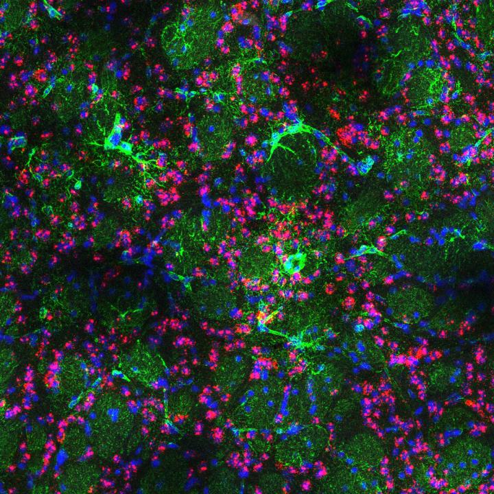 Huntington's Disease Mouse Brain