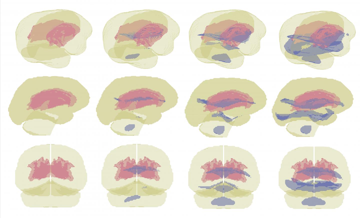 Vulnerable  Brain Regions During Side Hit to the Head